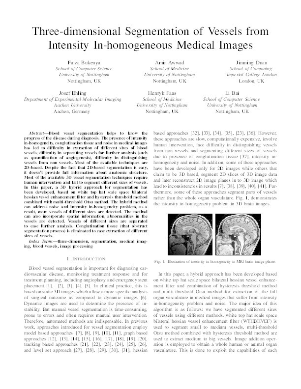 Three-dimensional Segmentation of Blood Vessels from Intensity In-homogeneous Medical Images Thumbnail