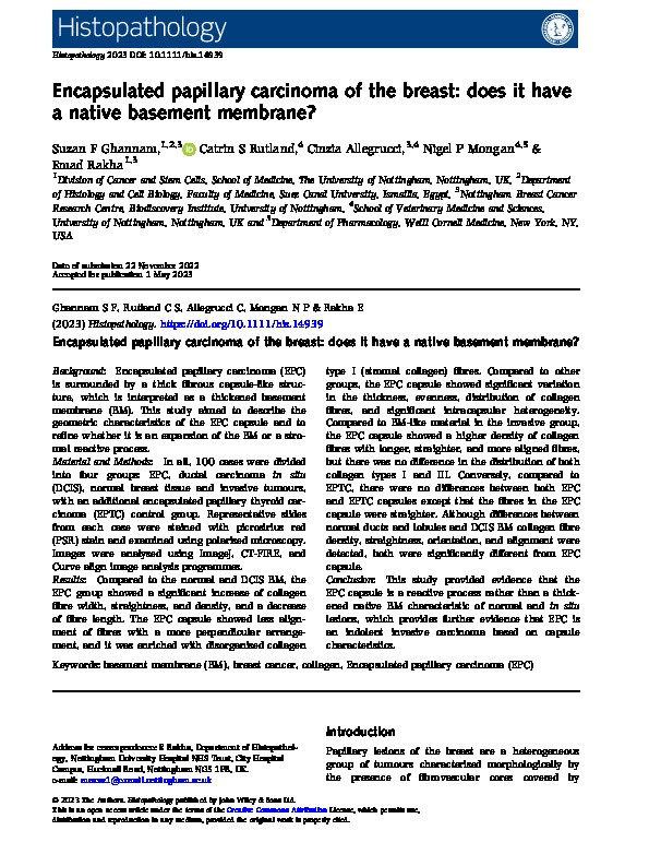 Encapsulated papillary carcinoma of the breast: does it have a native basement membrane? Thumbnail