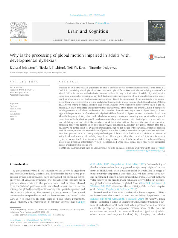 Why is the processing of global motion impaired in adults with developmental dyslexia? Thumbnail