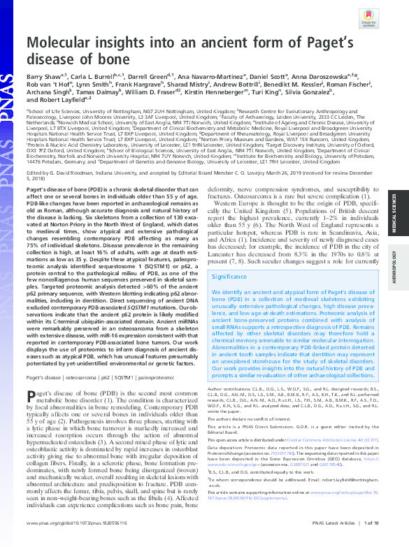 Molecular insights into an ancient form of Paget's disease of bone Thumbnail