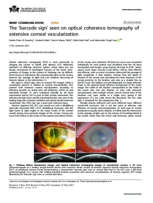 The ‘barcode sign’ seen on optical coherence tomography of extensive corneal vascularization Thumbnail