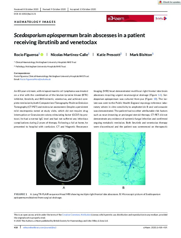 Scedosporium apiospermum brain abscesses in a patient receiving ibrutinib and venetoclax Thumbnail