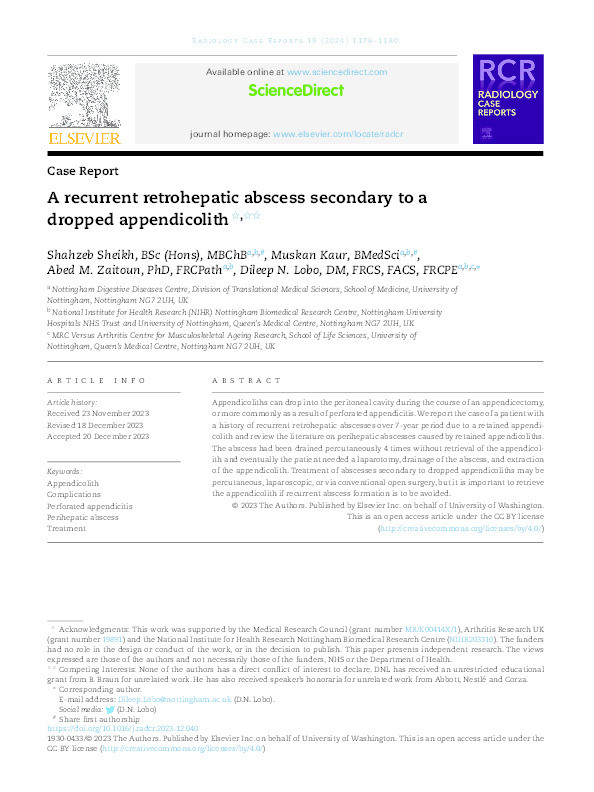 A recurrent retrohepatic abscess secondary to a dropped appendicolith Thumbnail