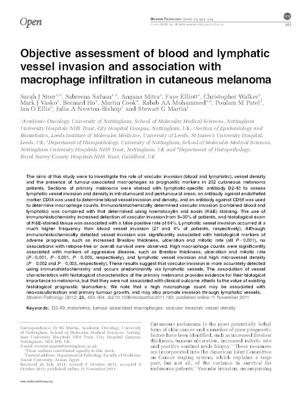 Objective assessment of blood and lymphatic vessel invasion and association with macrophage infiltration in cutaneous melanoma Thumbnail