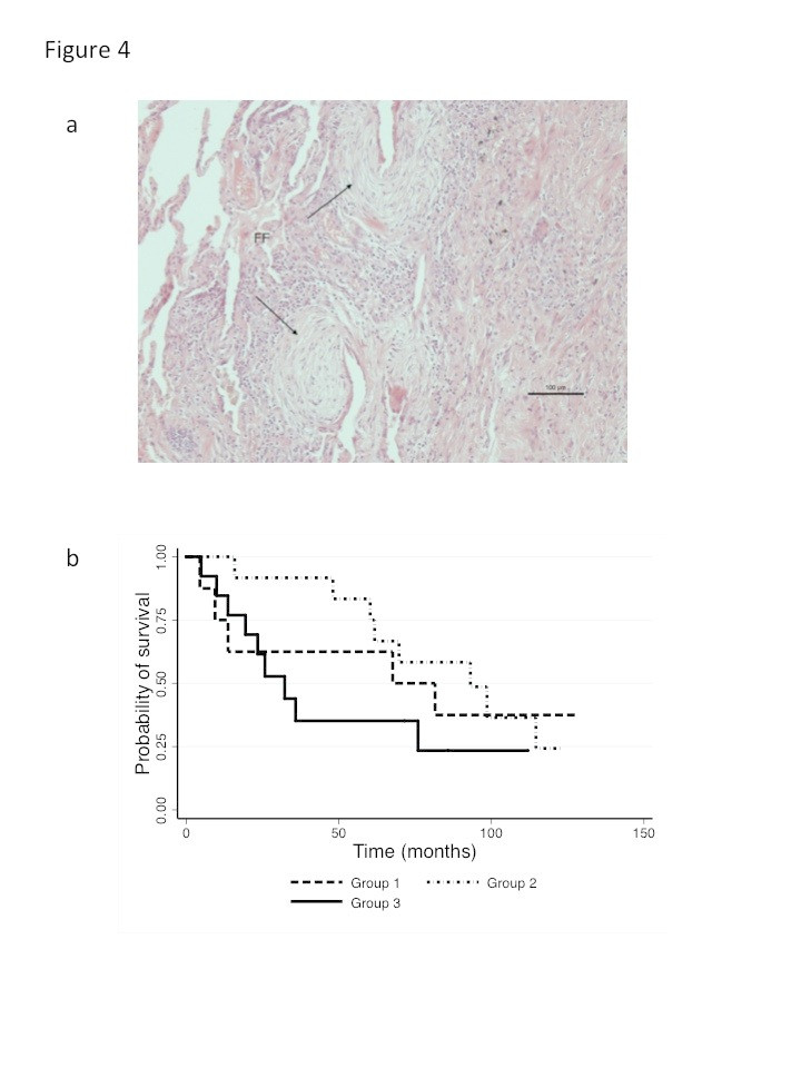 ?v?6 integrin may be a potential prognostic biomarker in interstitial lung disease Thumbnail