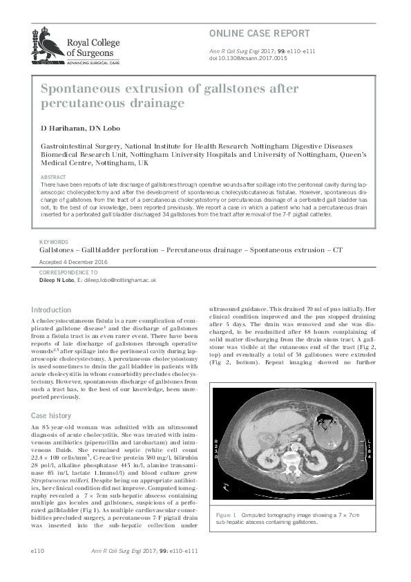 Spontaneous extrusion of gallstones after percutaneous drainage Thumbnail