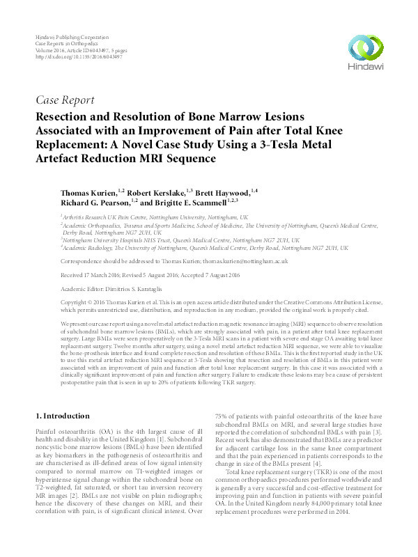 Resection and Resolution of Bone Marrow Lesions Associated with an Improvement of Pain after Total Knee Replacement: A Novel Case Study Using a 3-Tesla Metal Artefact Reduction MRI Sequence Thumbnail